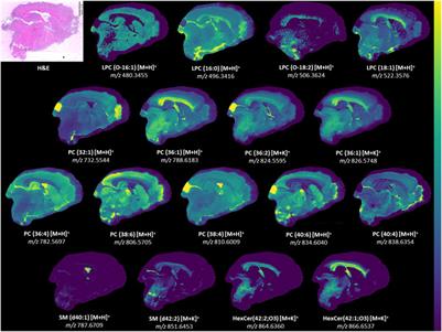 Spatial lipidomics maps brain alterations associated with mild traumatic brain injury